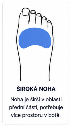 Široká noha dítěte